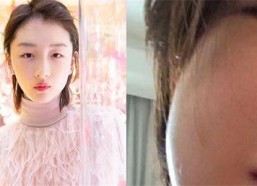 明星智齿,揭秘明星们的口腔秘密与美丽蜕变